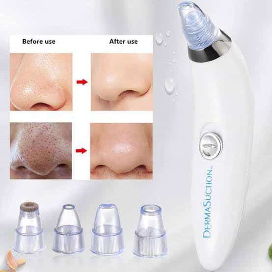 Derma suction Blackhead Remover Vacuum Acne Cleaner Black Spots Removal