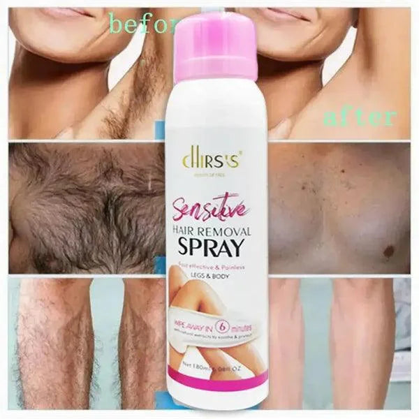 Chirs’s Fast Effective & Painless Hair Removal Spray For Legs & Body (180ml)